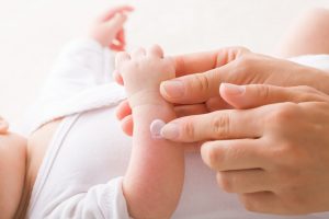 Dermatitis atópica en el recién nacido